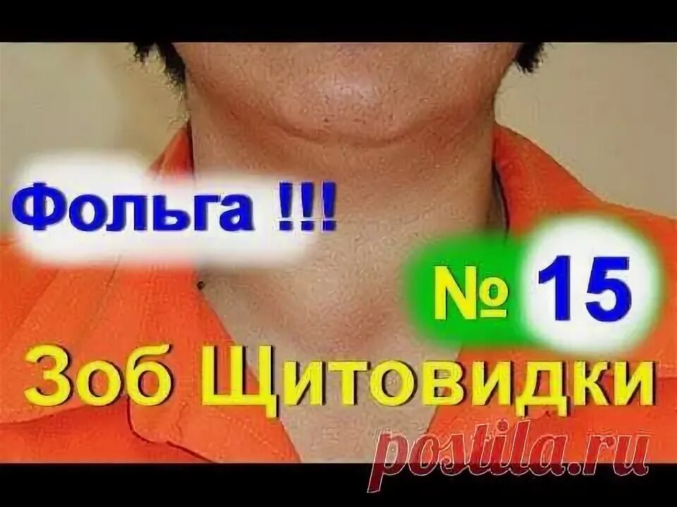Узловой зоб народные средства. Узловой зоб презентация. Узловой зоб щитовидной железы. Многоузловой токсический зоб причины. Народные средства для щитовидной железы.