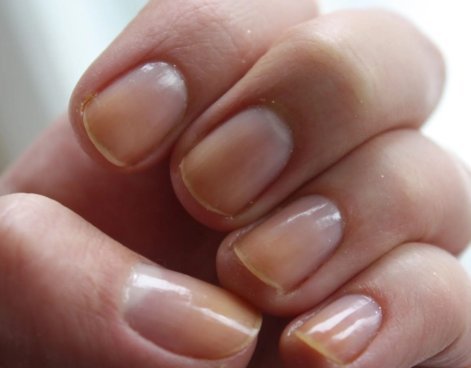 Красивые ногти без лака. Маникюр на тонкие и ломкие ногти. Сломанный ноготь под гель лаком. Тонкие ногти. Гель лак ломкие ногти.