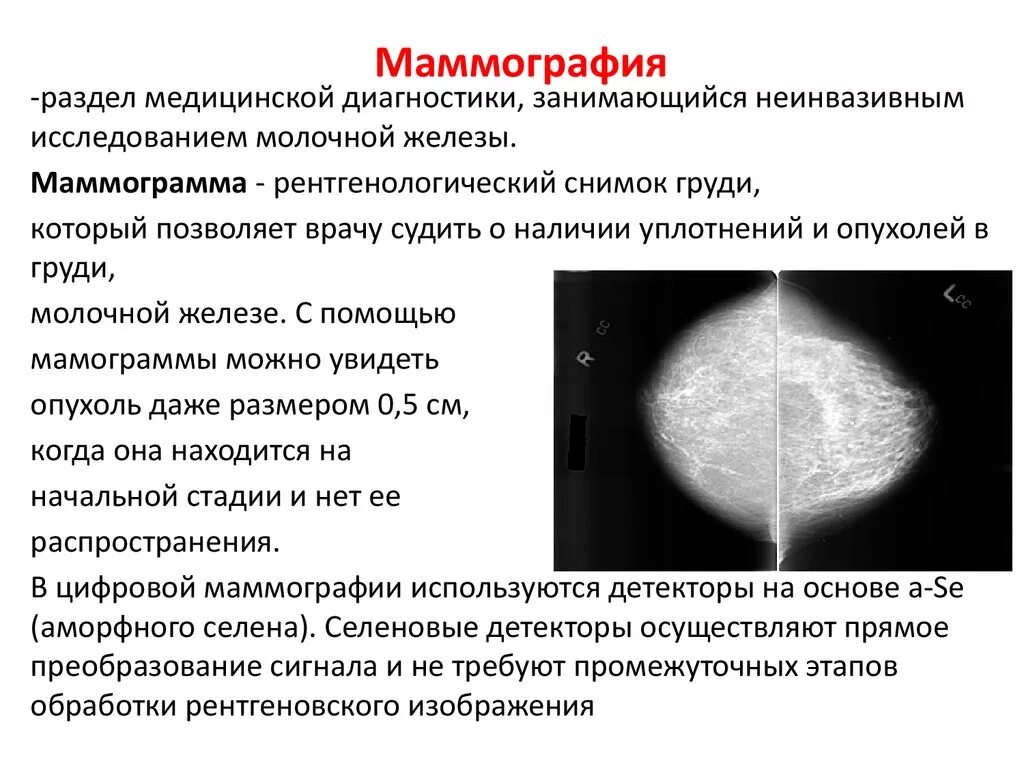 Анализ маммографии. Электроимпедансная маммография заключение. Мамаогра. Описание маммографии. Молочная железа маммография.