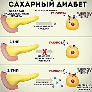 Сахарный диабет недостаток инсулина