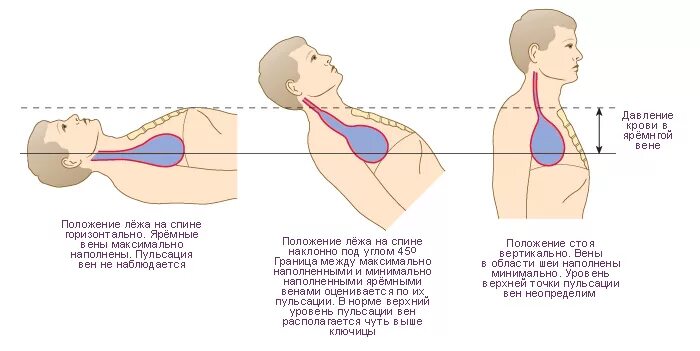 Положения сидя стоя разница давления. Как измерять давление лежа или сидя. Давление в лежачем положении. Нагрузка на позвоночник в разных положениях. Давление лежа сидя и стоя.