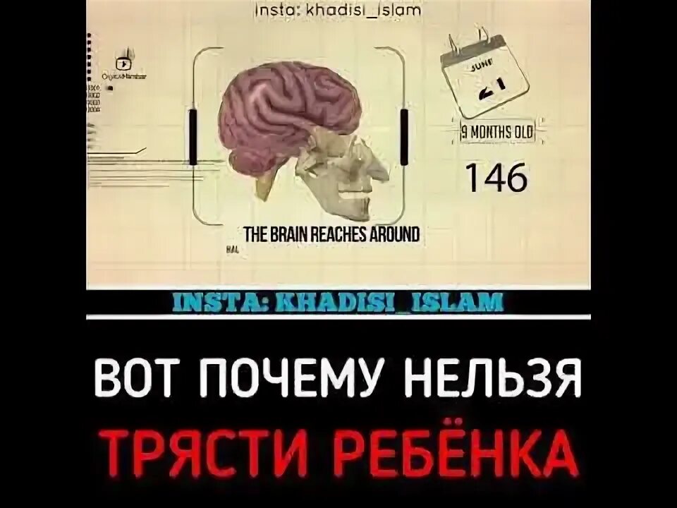 Почему нельзя трясти. Синдром встряхнутого ребенка. Почему нельзя трясти младенца. Почему нельзя трясти грудничка.