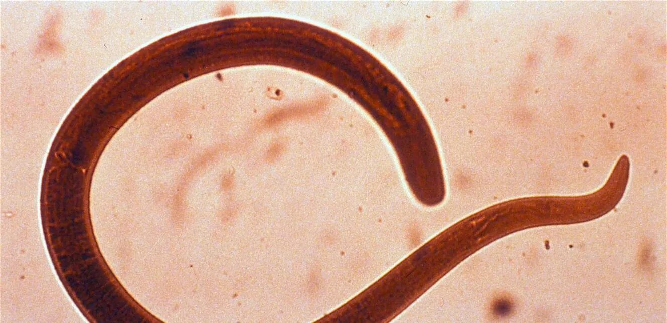 Category:Ancylostoma caninum - Wikimedia Commons