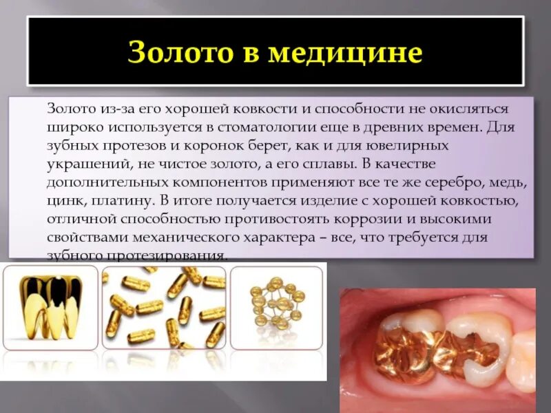 Золото в медицине. Золото в стоматологии. Применение золота. Золото для презентации.