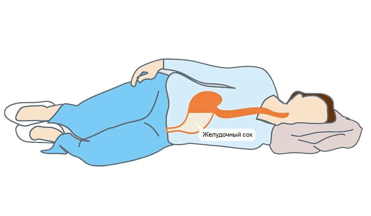 Нельзя лежать днем. Правильная поза для сна на боку. Поза сна для пищеварения. Поза для сна на левом боку. Полезные позы для сна.
