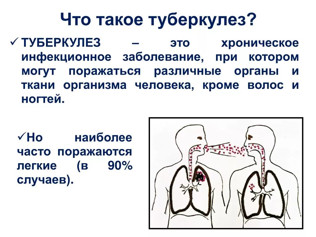 При туберкулезе чаще поражаются