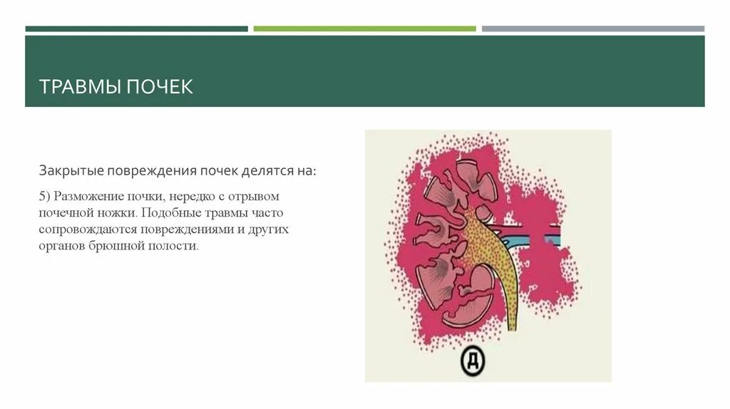 Закрытая травма почки симптомы. Травма почки классификация. Повреждение почек. Травма почки классификация. Открытые повреждения почек.