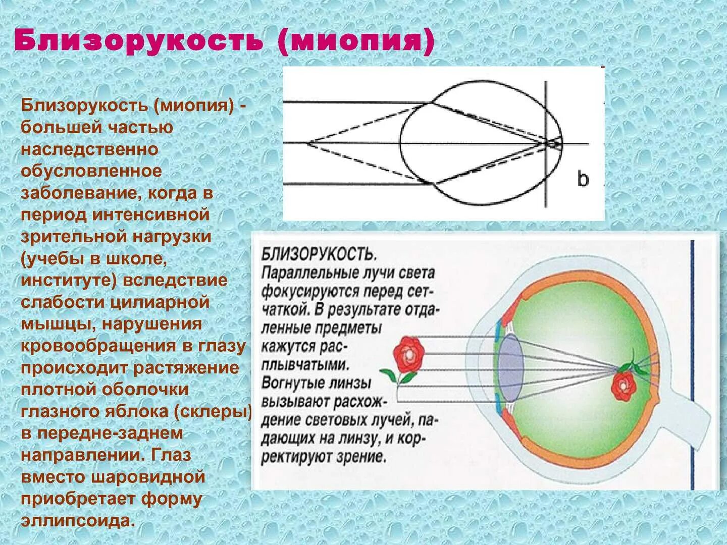 Глаз имеет оптическую силу