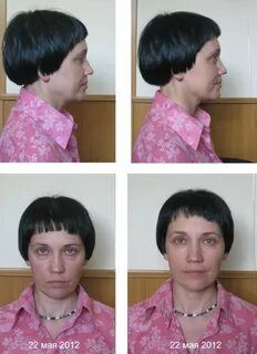 Гимнастика для лица отзывы