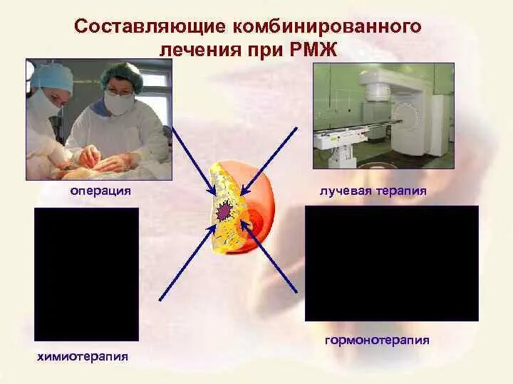 Лучевая терапия после операции. Лучевая терапия при онкологии молочной железы. Терапии лучевая терапия при РМЖ. Лучевая терапия при онкологии молочной железы прооперированной. Химия после операции рака