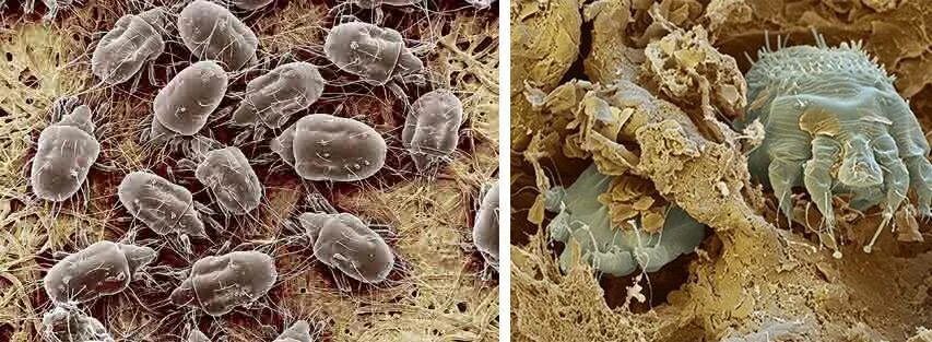 Клещи паразиты таблетки. Чесоточный клещ под микроскопом. Чесоточный клещ Sarcoptes scabiei.