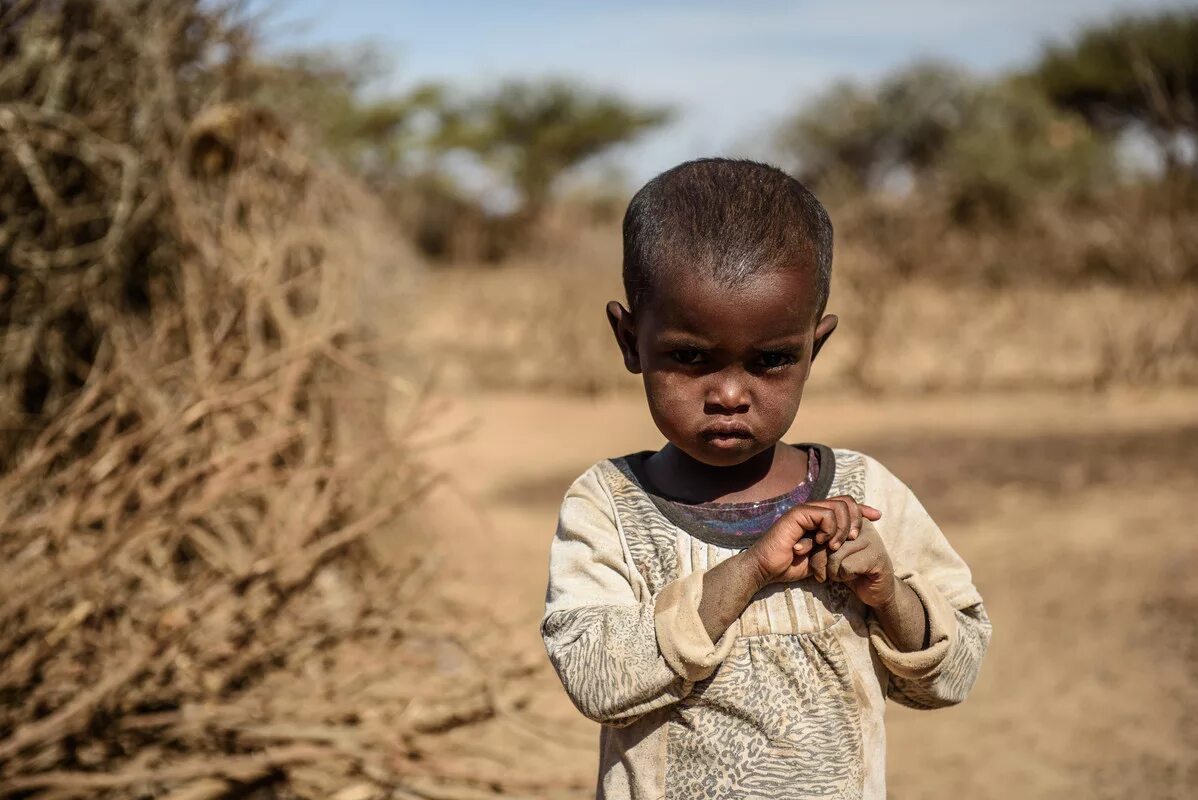 Африканские дети мальчики. Африканские дети Голодные. Starving help