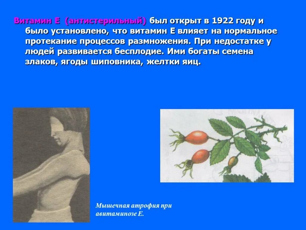 Заболевания при недостатке е. Витамин e при недостатке. Заболевания при недостатке витамина е. Заболевания при дефиците витамина е. Болезни при недостатке витамина e.