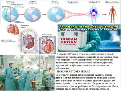 Пересадка органов отторжение