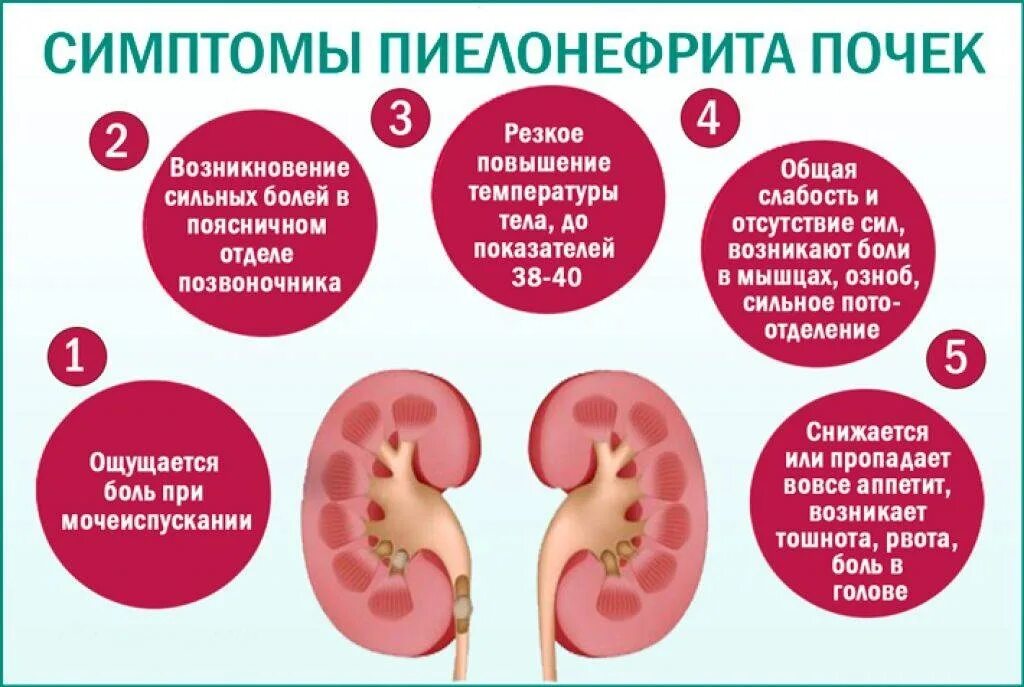 Как называется воспаление почек. Болезнь почекпилонефрит. полинифрит почек симптомы. ренальные симптомы пиелонефрита. пиелонефрит почек симптомы.