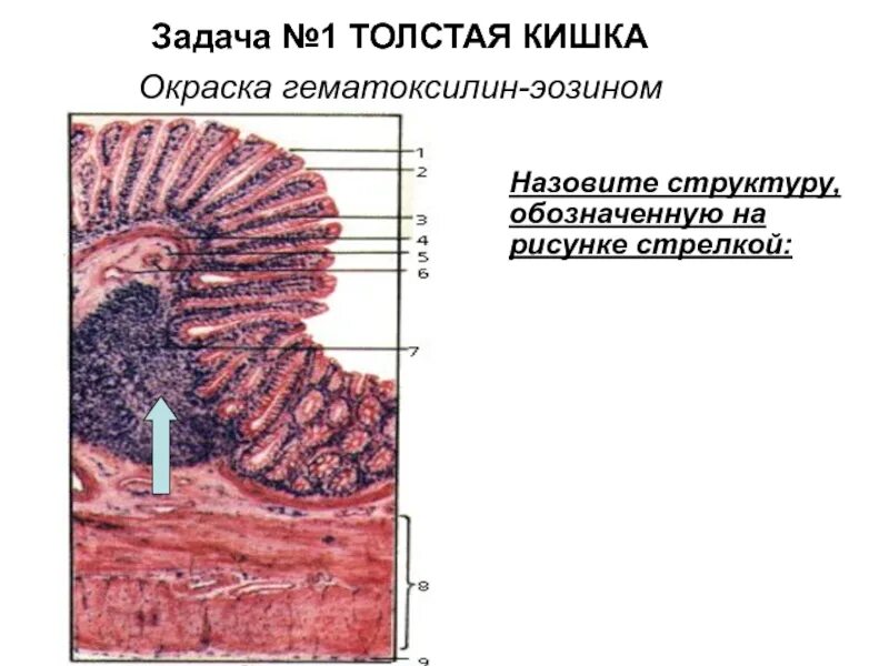 Слизистая оболочка 12 кишки. Толстая кишка гистология препарат. Эпителий Толстого кишечника гистология. Толстая кишка окраска гематоксилин-эозином. Толстый кишечник гистология препарат.