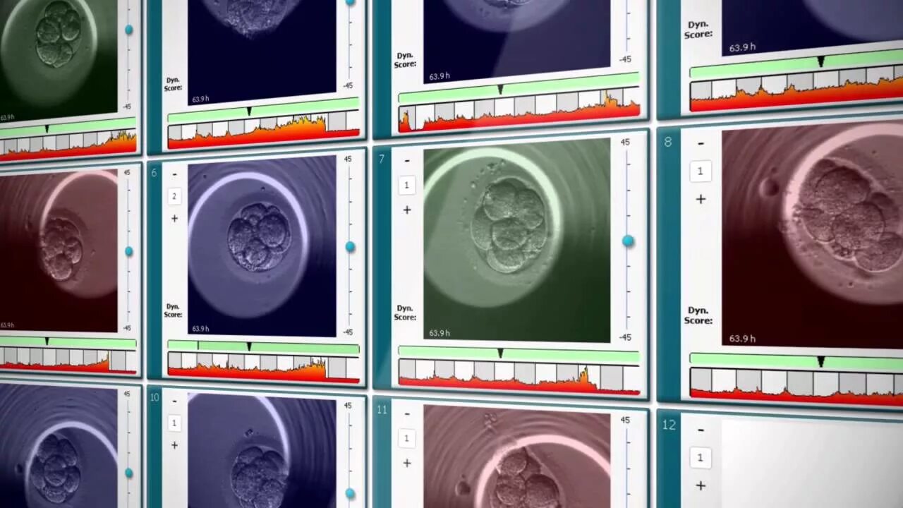 Эмбриоскоп. Развитие эмбриона в эмбриоскопе. Embryoscope time-lapse System.