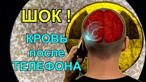 Шок дзен