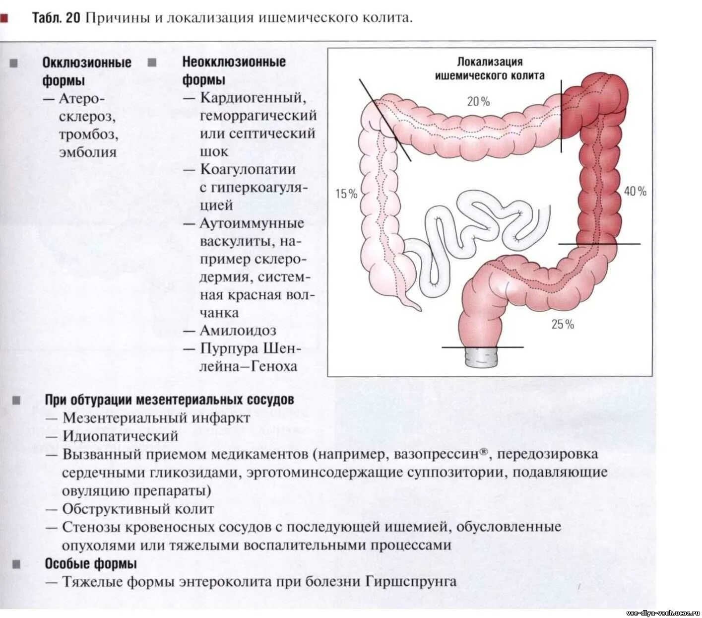 Сигмовидная кишка где находится и симптомы