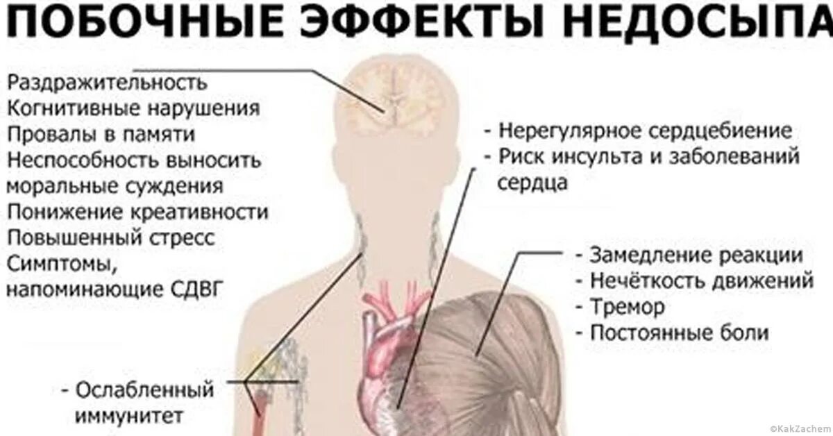 Побочные эффекты недосыпания. Симптомы сильного недосыпа. Признаки недосыпа. Недосыпание симптомы. Болезнь провалы в памяти