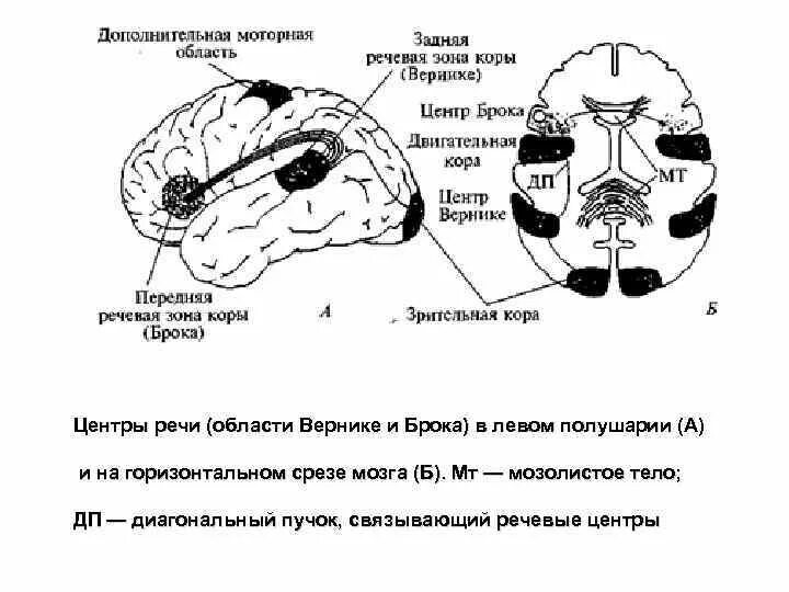 Центр речи в мозге человека. Речевые центры. Зона Брока. Зона Вернике. Центры речи в головном мозге Брока и Вернике. Зоны речи Брока, Вернике. Схема центра Брока и Вернике.