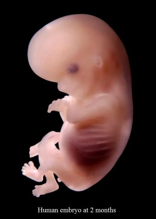 11 недель беременности 2 беременность. Плод на 11 неделе беременности. Эмбрион на 11 неделе беременности. Ребёнок 11 недель беременности эмбрион. 11 Недель беременности фото плода.