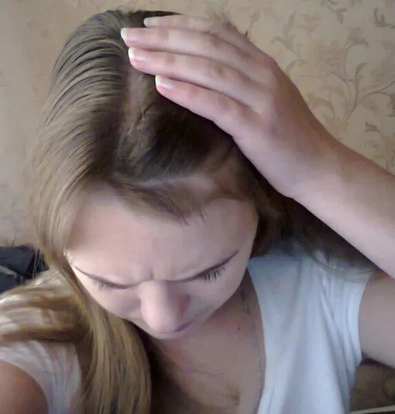 Волосы непослушными вихрами. Прическа с вихром на челке у женщин. Вихор на челке. У челки редеют волосы. Как убрать вихор.