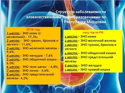Зно предстательной железы