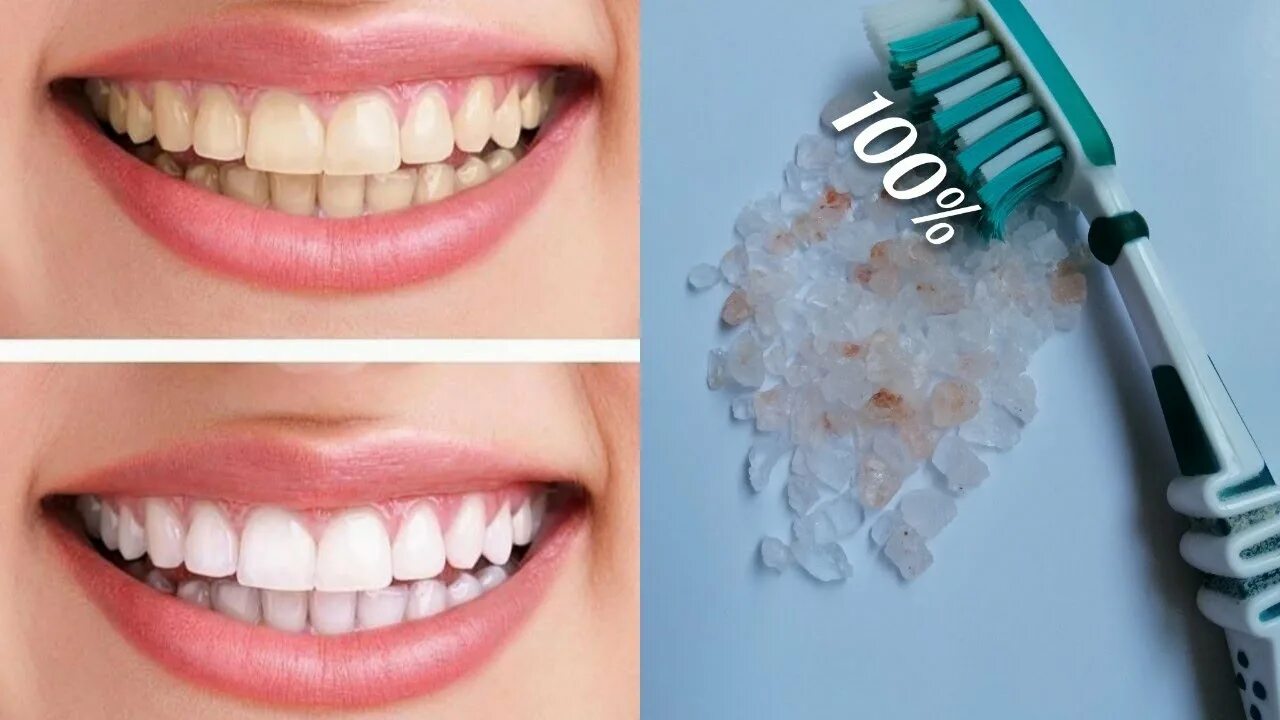 Как сделать зубы белее в домашних условиях