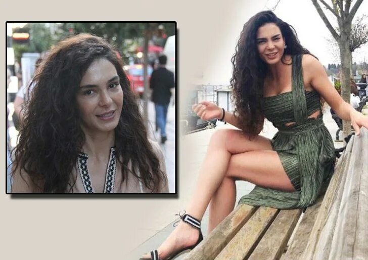 эбру шахин до пластики. эбру шахин стамбульская невеста. эбру шахин пластика.