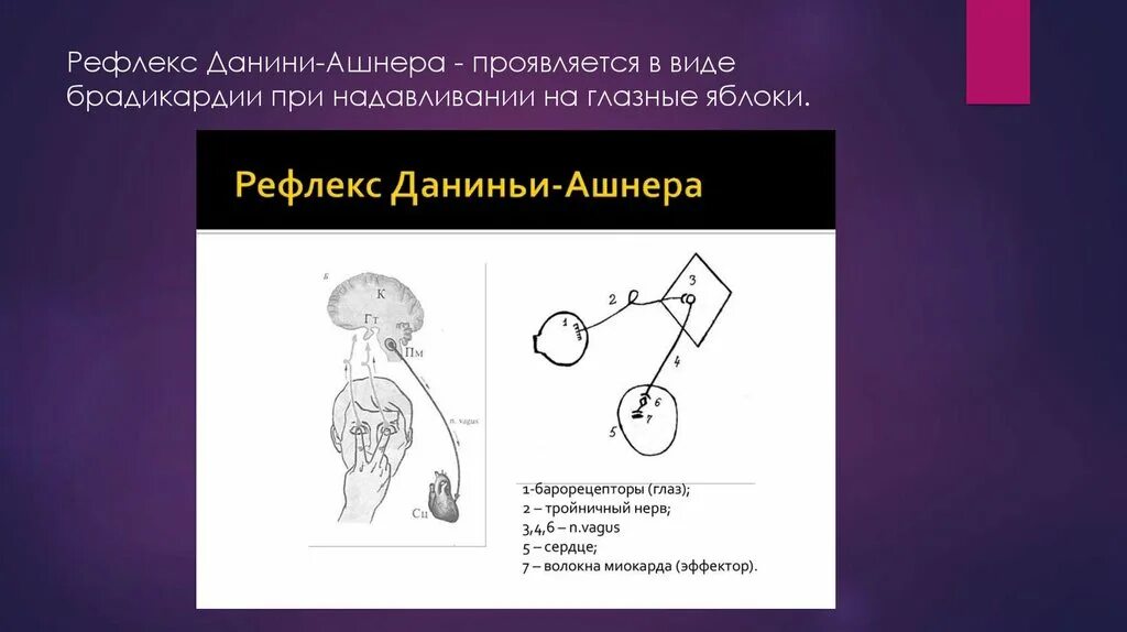 Рефлекс лифта. Рефлекторный путь рефлекса Данини-Ашнера. Рефлекс Данини Ашнера рефлекторная дуга. Данини Ашнера рефлекс механизм. Схема рефлекторной дуги рефлекса Данини Ашнера.