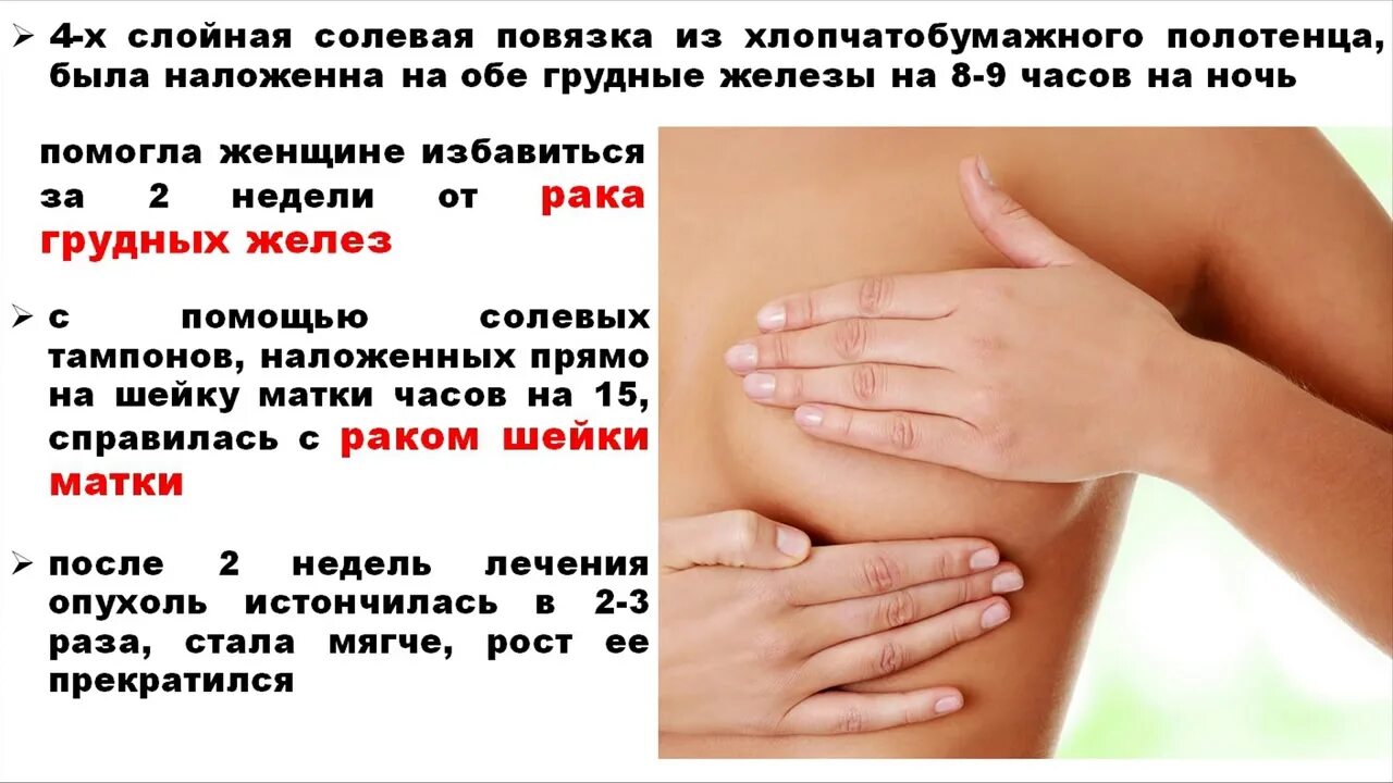 Можно ли делать солевые. Солевые повязки на грудные железы. содовые повязки при онкологии. соляные повязки на молочную железу. солевые повязки при онкологии.