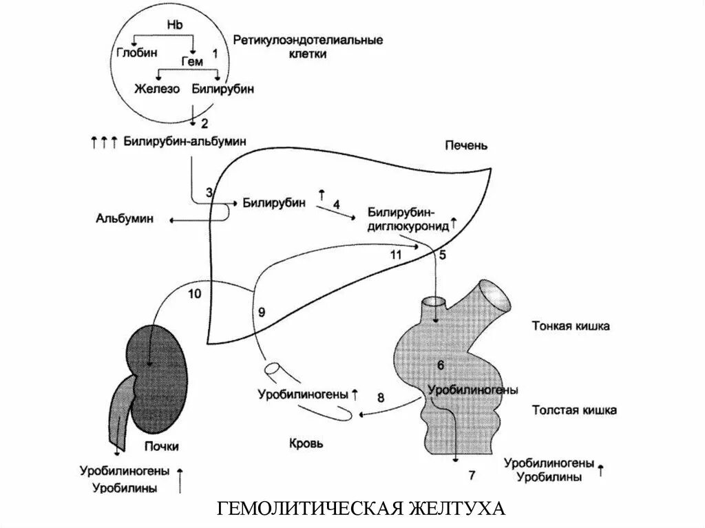 Кровь образуется в печени. Метаболизм билирубина схема. Схема катаболизма билирубина при гемолитической желтухе. Схема метаболизма билирубина биохимия. Нарушение метаболизма билирубина при гемолитической желтухе.