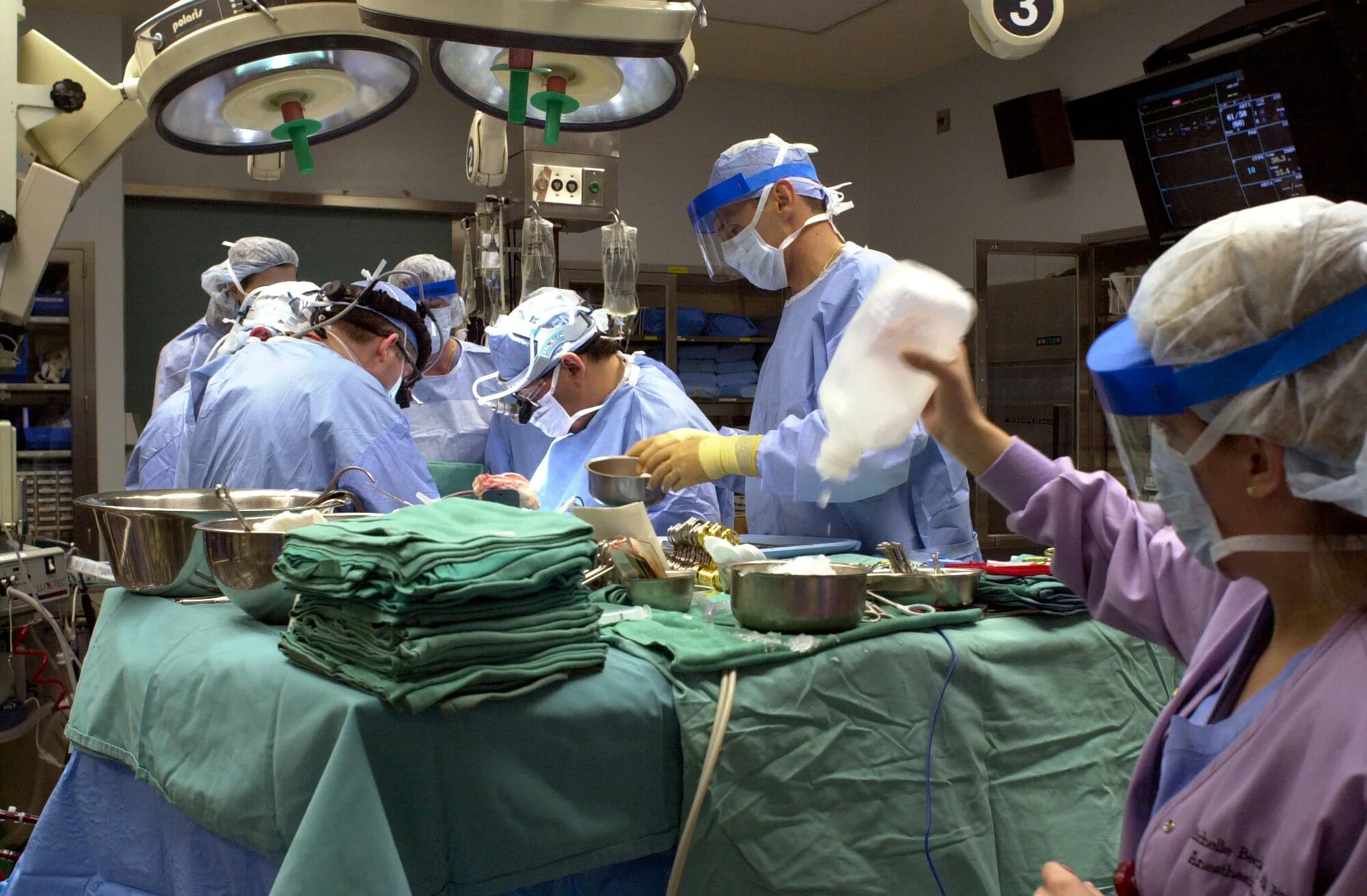 Пересадка органа от донора. Дэвид Беннетт операция. Трансплантология органов. Трансплантация органо.