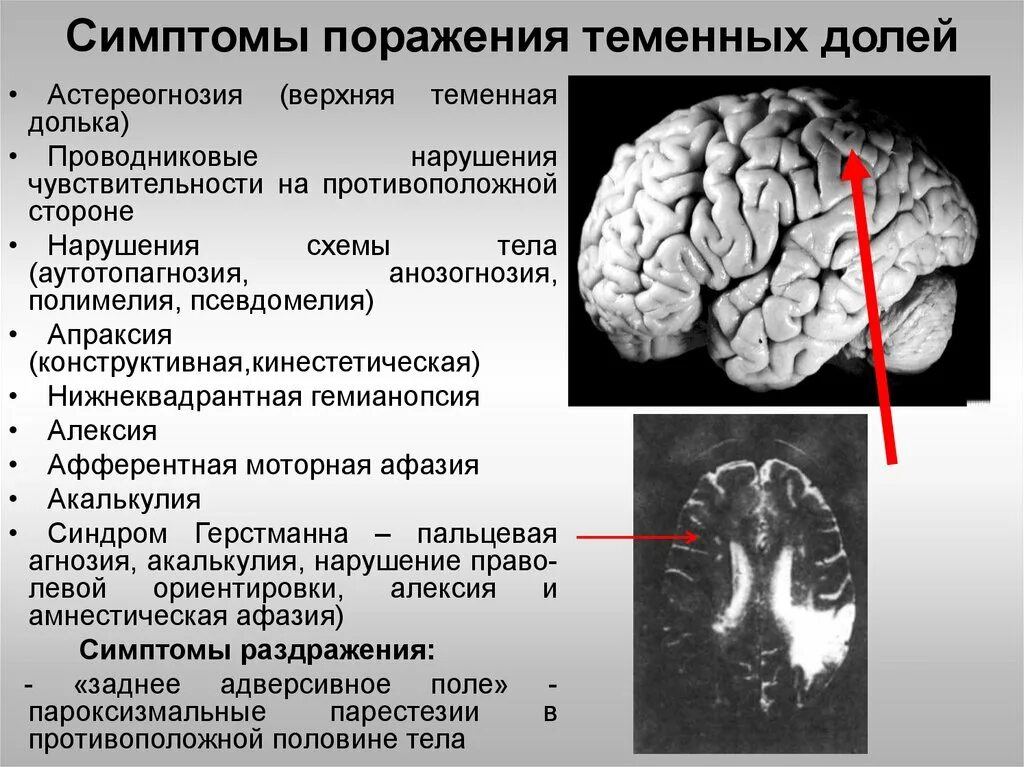 Поражение теменной коры