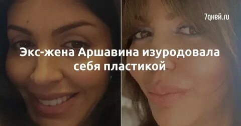 Алиса пластика