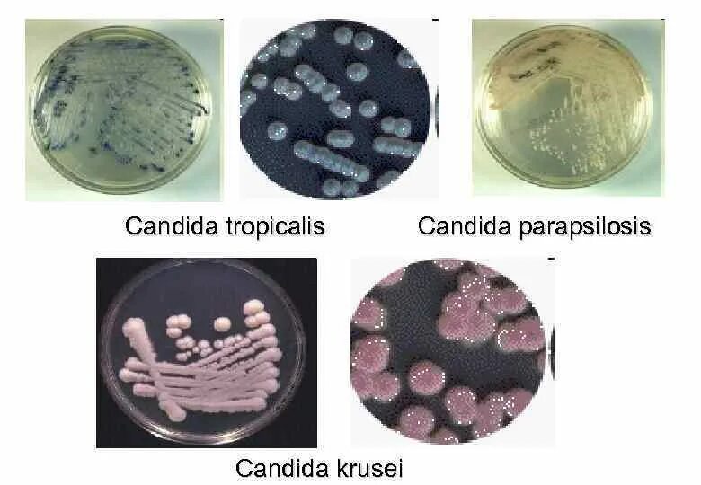 Candida albicans полукол. Дрожжи кандида. дрожжеподобные грибы кандида микробиология. грибы рода candida микробиология. candida spp микробиология.