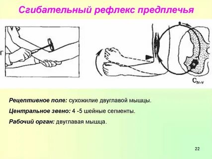 Двуглавый рефлекс