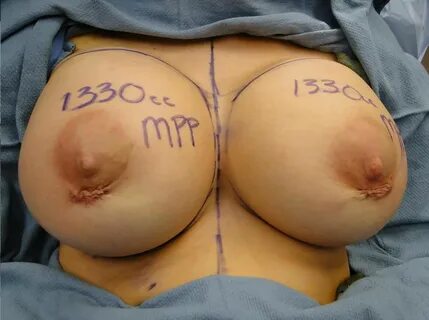 Huge milking boobs Porn Pics and XXX Videos.