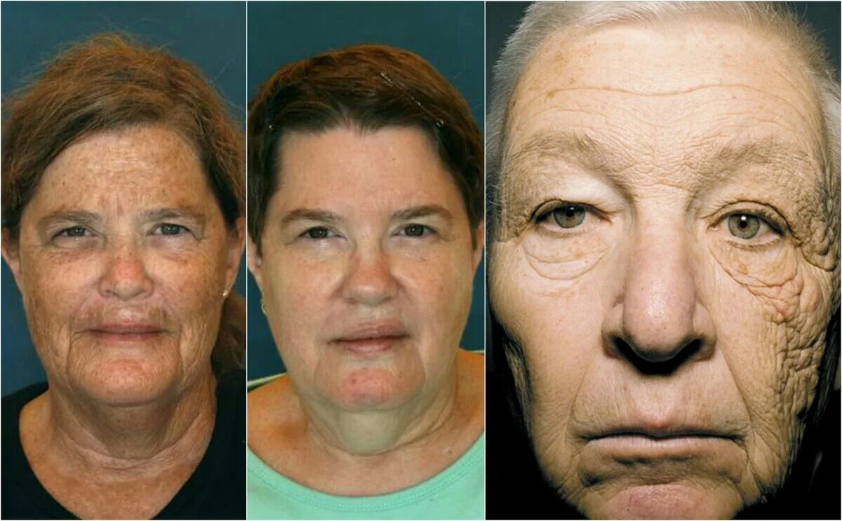 Лицо дальнобойщика. Лицо водителя фуры. Грустный дальнобойщик. Фотостарение кожи. Лицо дальнобойщика.