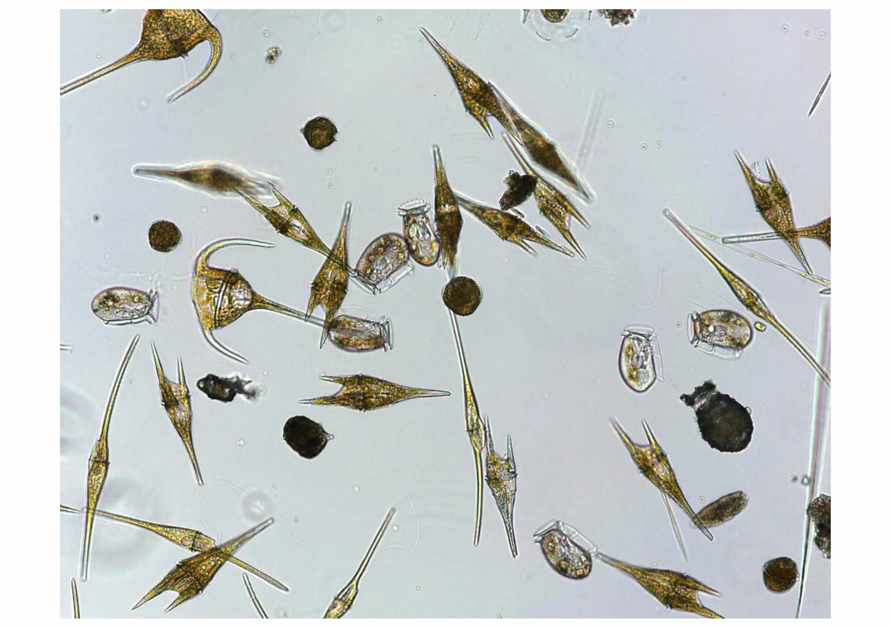 Детрит фитопланктон это. Фитопланктон под микроскопом. Пробы фитопланктона. Биоразнообразие фитопланктона.