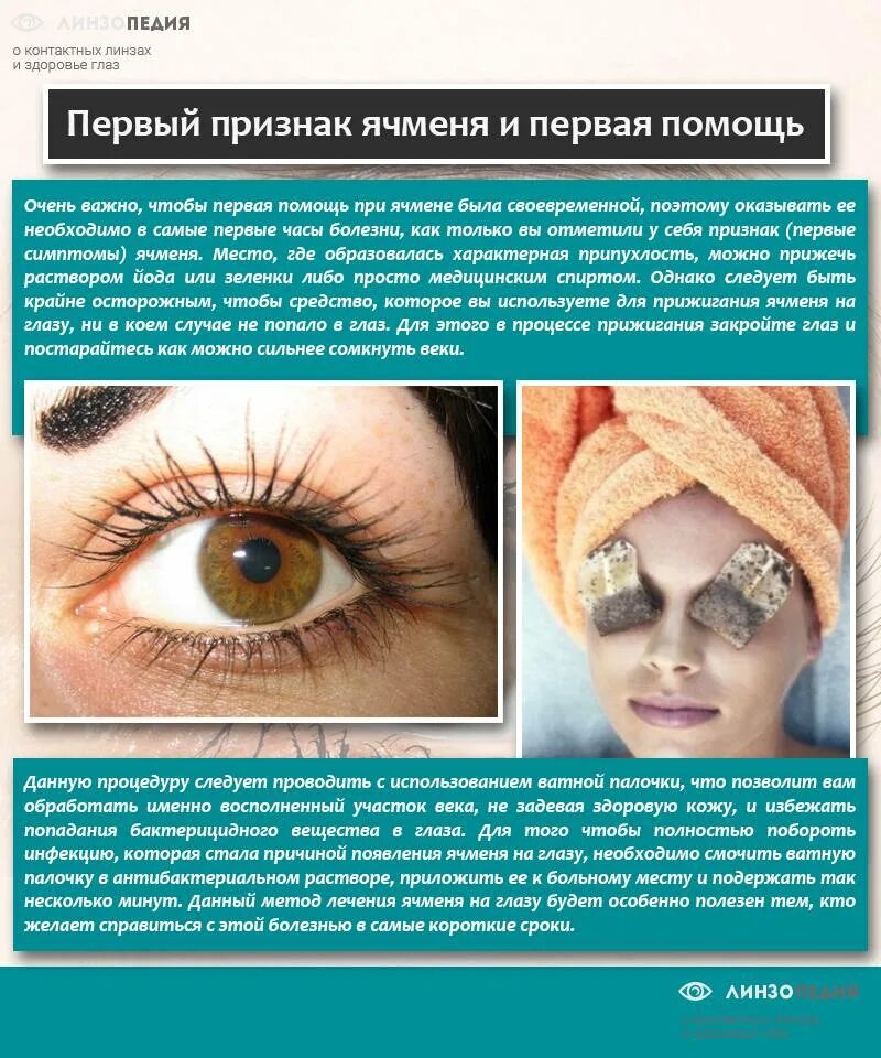 Ячмень на глазу как лечить быстро лекарствами. Ячмень на глазу как лечить быстро лекарствами