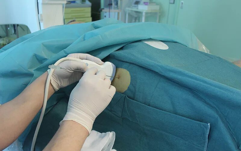Современные Методы определения фиброза печени Інтернет-видання "Новини медицини 