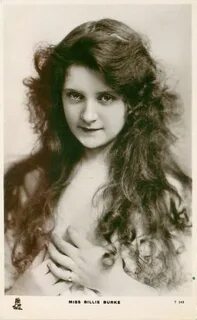 Miss billing