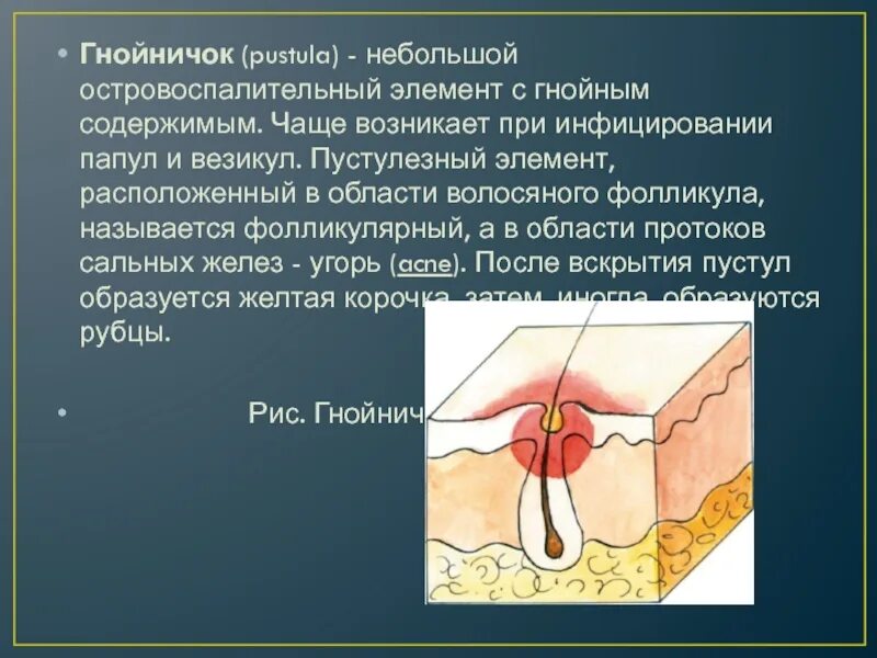 Папула элемент. Папула элемент