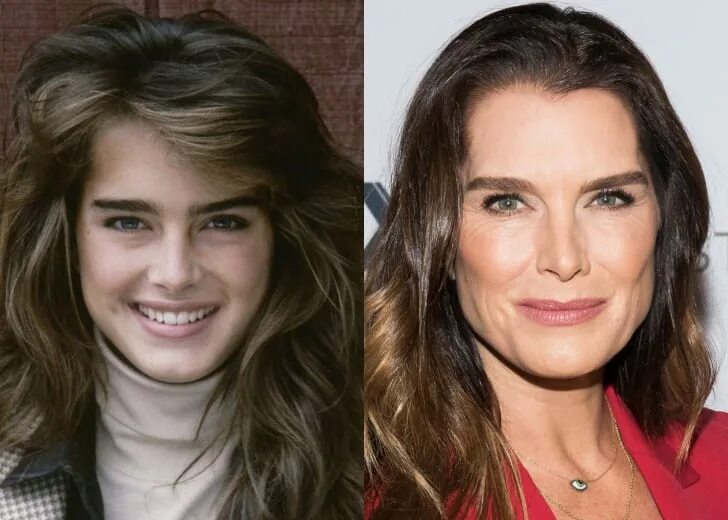 Синди кроуфорд мышечный морфотип старения. Синди кроуфорд тип старения. Синди кроуфорд мышечный морфотип старения. Мускульный тип старения кожи лица. Мускульный тип старения синди кроуфорд.