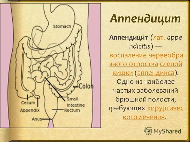 Аппендицит в 2 года