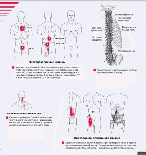 Триггерные точки это простыми словами. Миостимулятор от триггерных точек. Триггерные точки на теле карта. Триггерная цепь в организме. Триггерные точки книга.