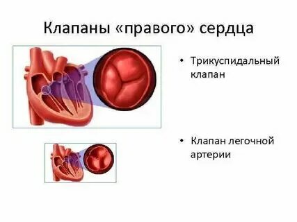 Пульмональная регургитация 1 степени что это такое