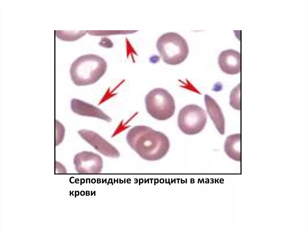 Пигмент эритроцитов